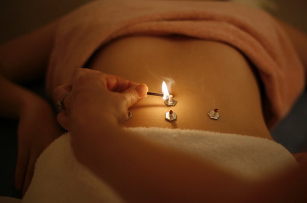 Moxibustion | Merkle Dubois TCM Praxis Basel